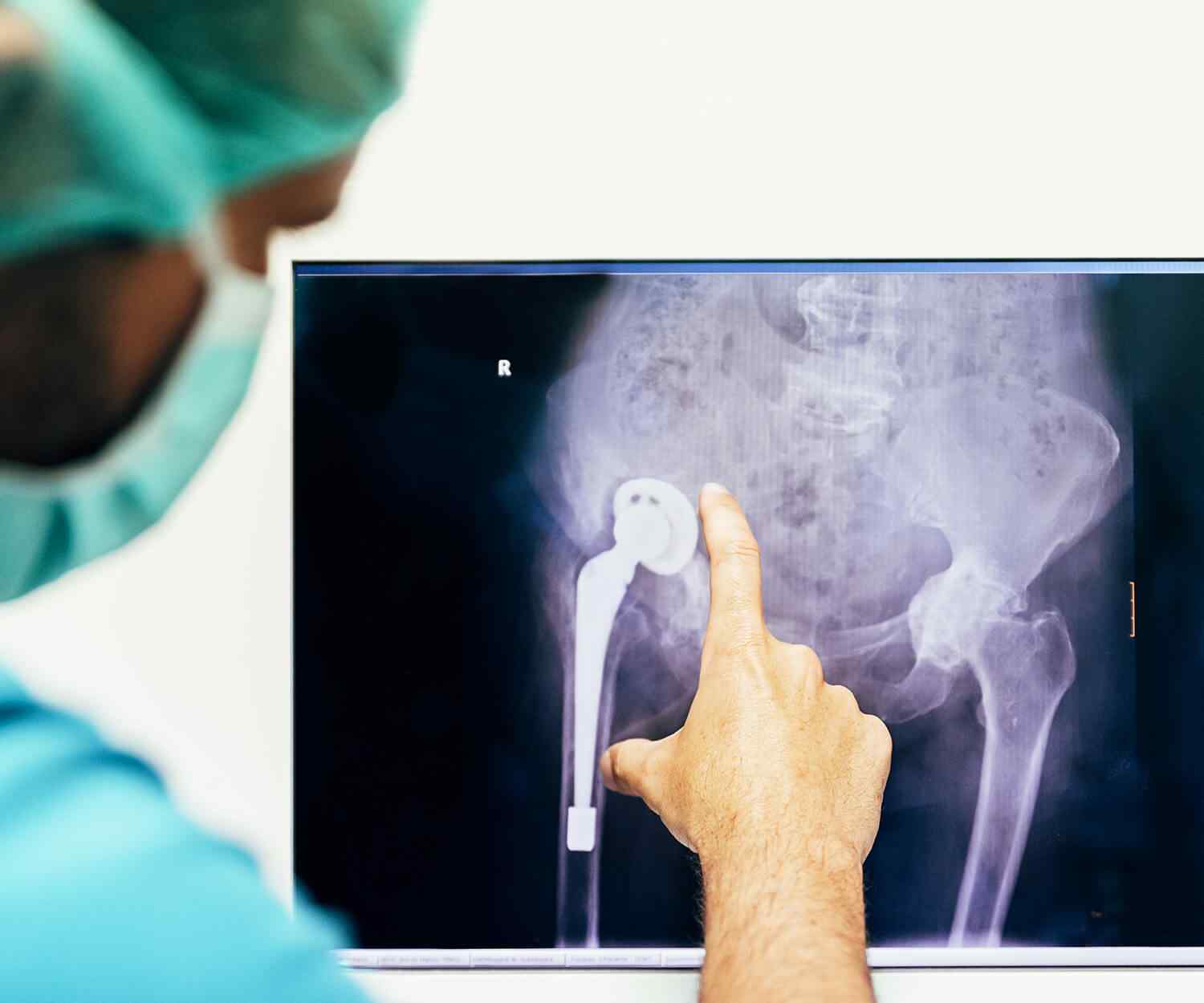 https://www.oncoprecision.cl/wp-content/uploads/2021/08/card_image_05.jpg